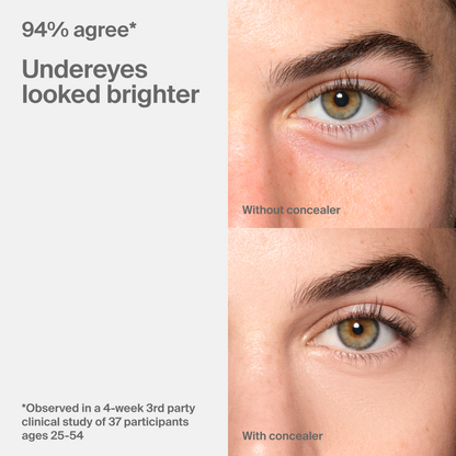 Triclone™ Skin Tech Concealer