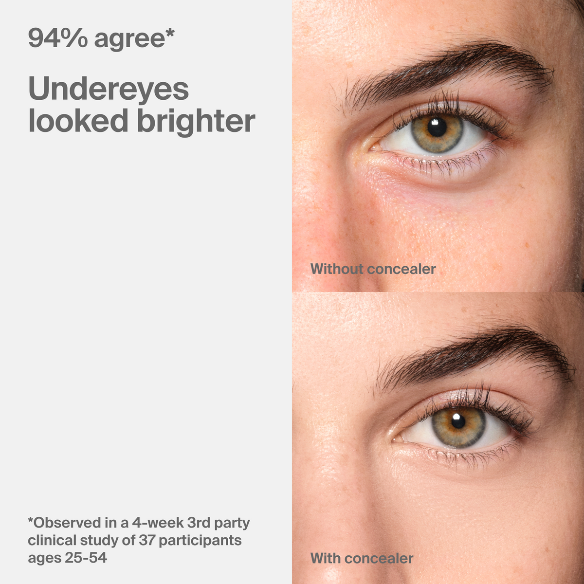Triclone™ Skin Tech Concealer
