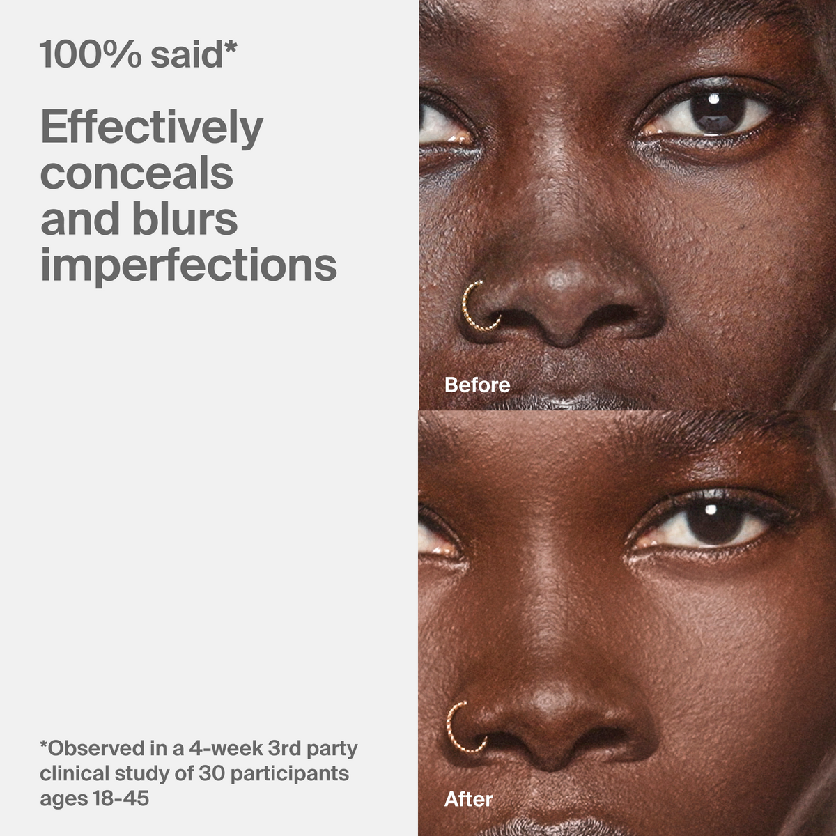 Triclone™ Skin Tech Concealer
