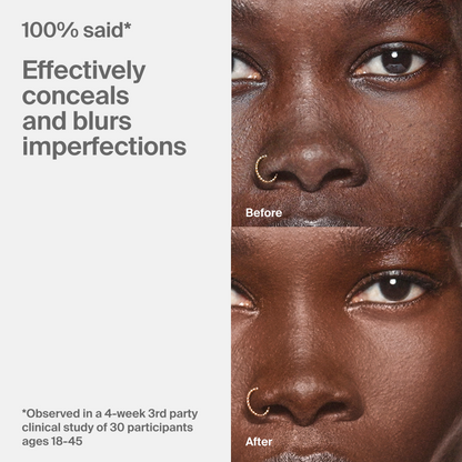 Triclone™ Skin Tech Concealer