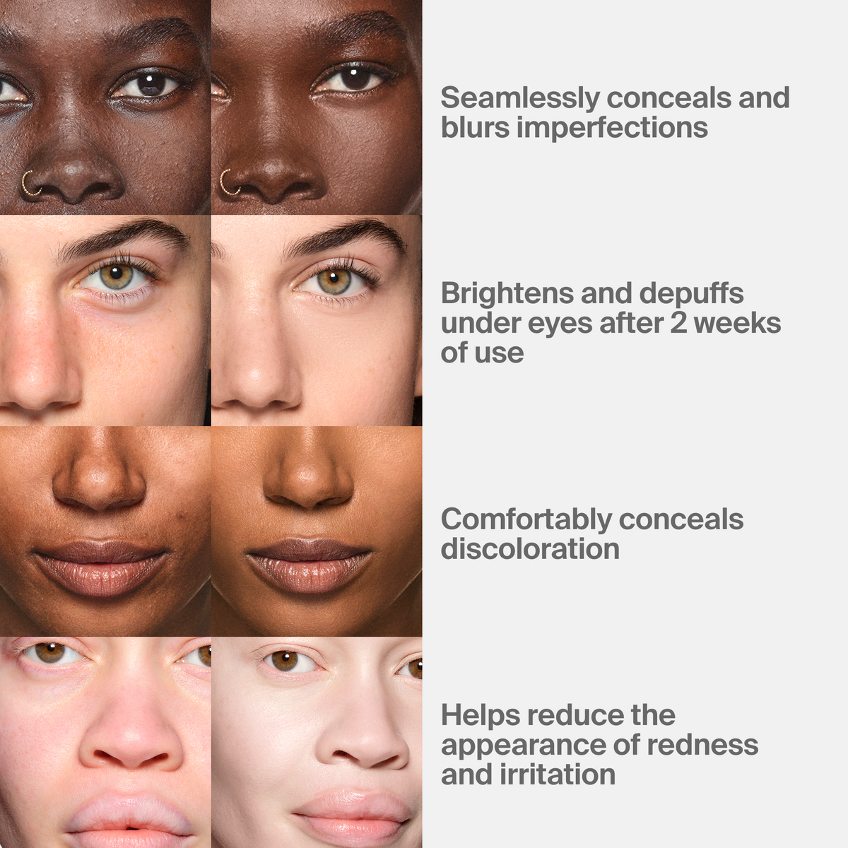 Triclone™ Skin Tech Concealer