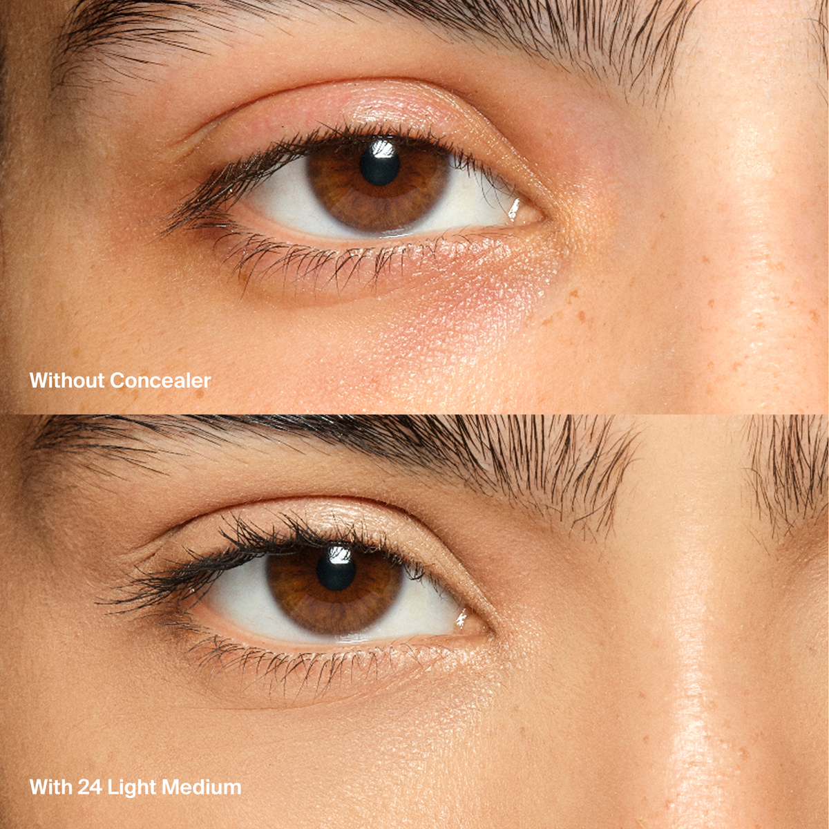 Triclone™ Skin Tech Concealer