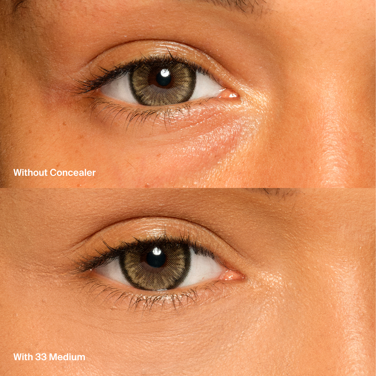 Triclone™ Skin Tech Concealer