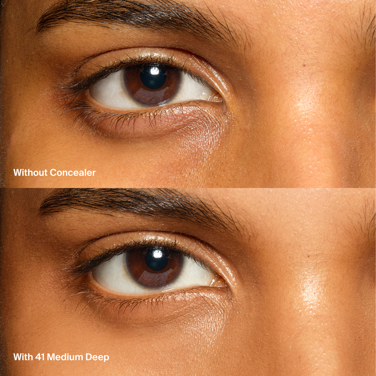 Triclone™ Skin Tech Concealer