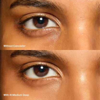 Triclone™ Skin Tech Concealer