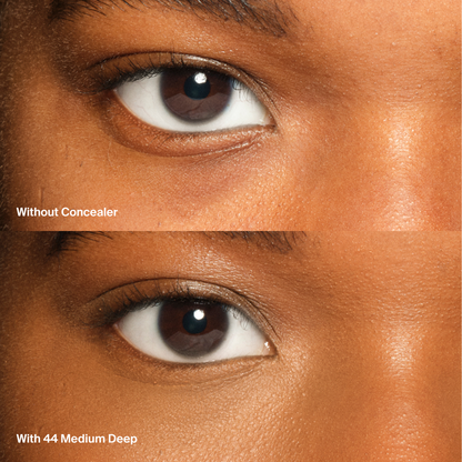 Triclone™ Skin Tech Concealer