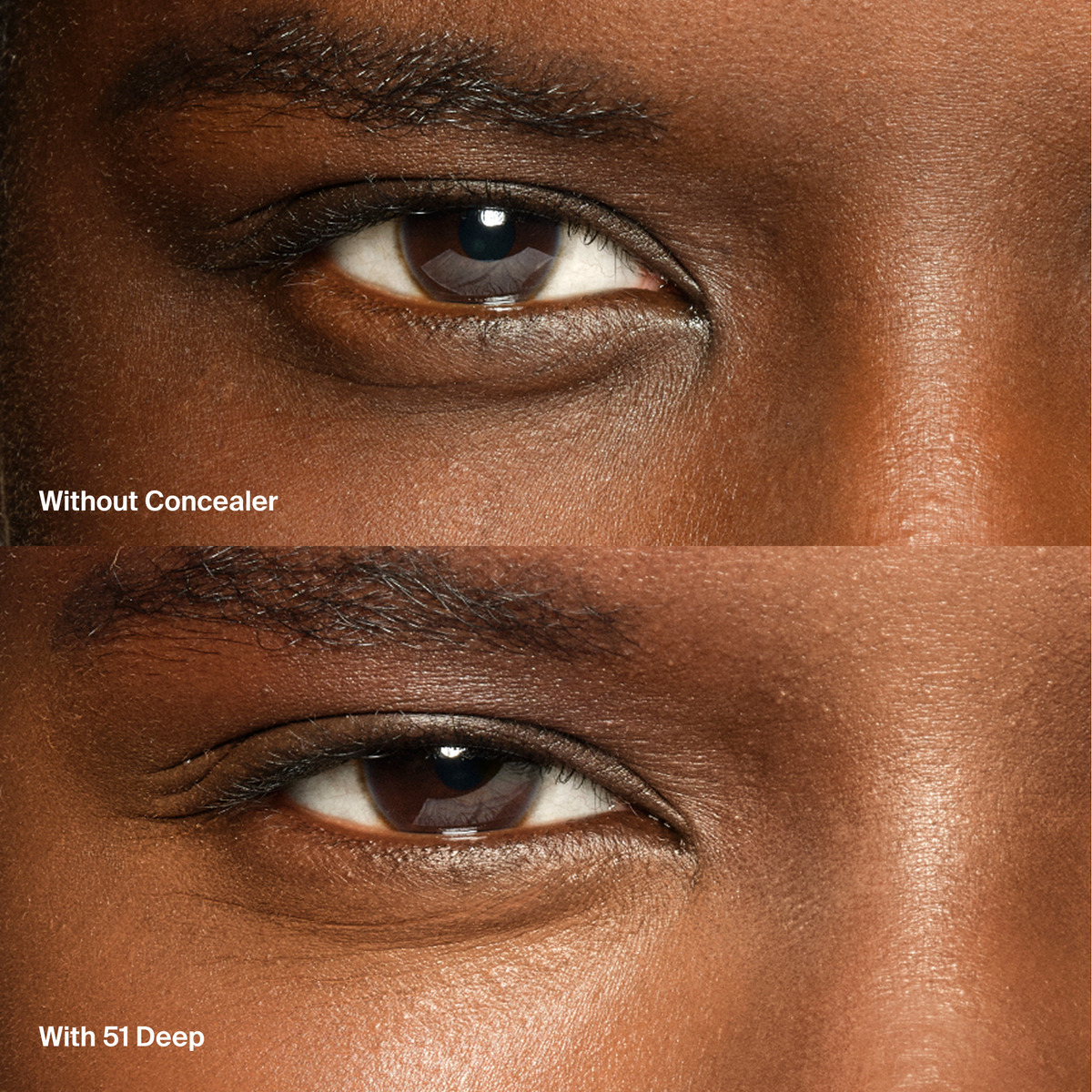 Triclone™ Skin Tech Concealer