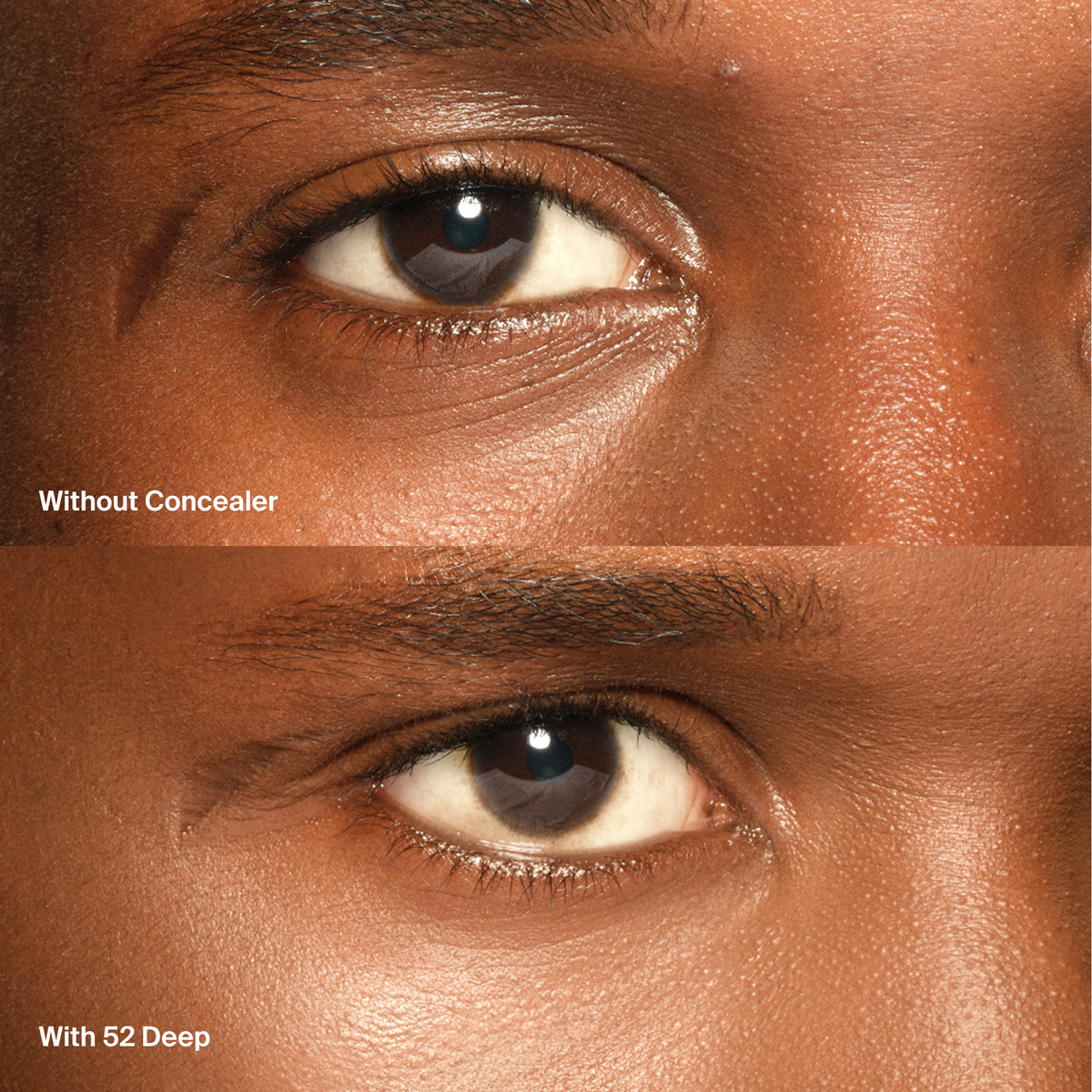 Triclone™ Skin Tech Concealer